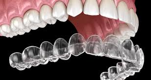 Preventive dental checkup